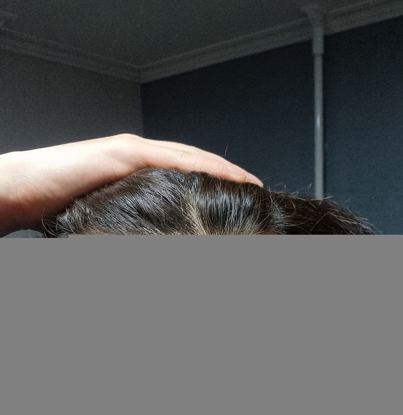 피나바르기전