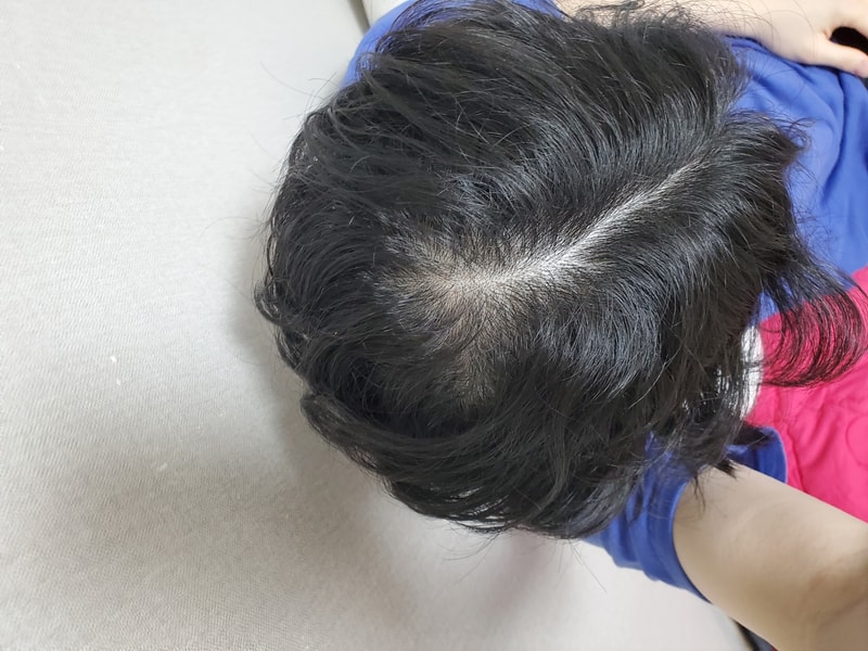 약을 먹는데도 갑자기 털리는거같은..ㅠ22살남