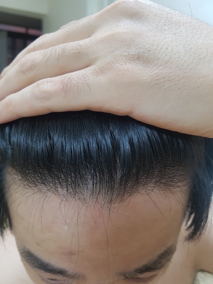 헤어라인