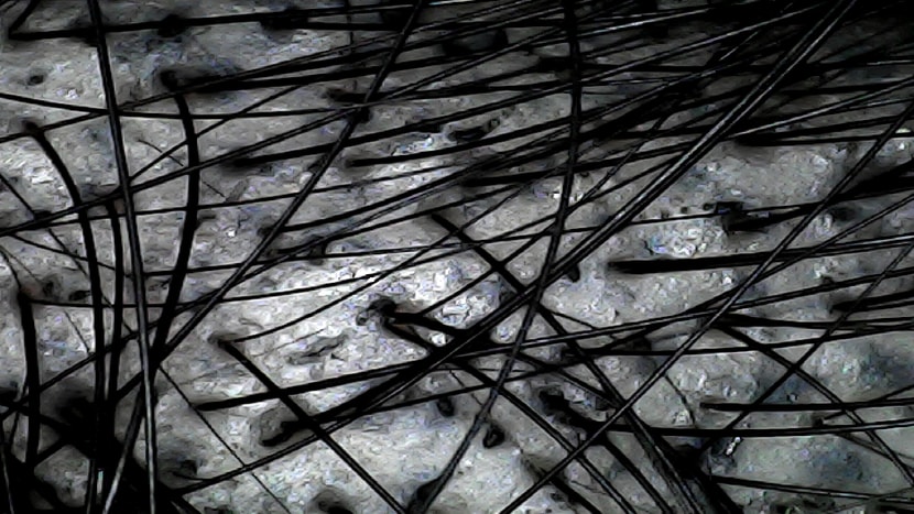 정수리앞 전두부