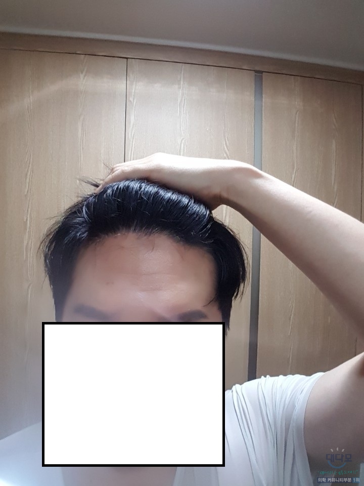 1년전 사진