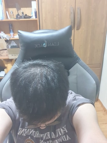 조합약+주사 3개월차(치료 9개월차)