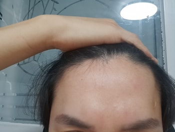 정면