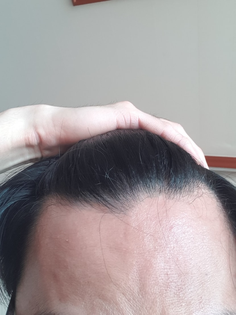 거의 한달 지난 후