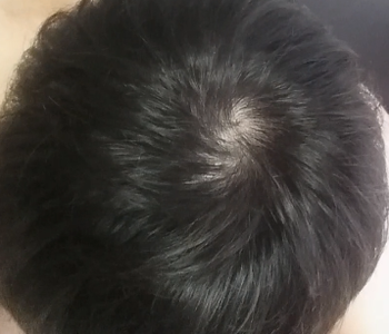 2019년
