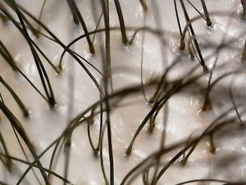 정수리