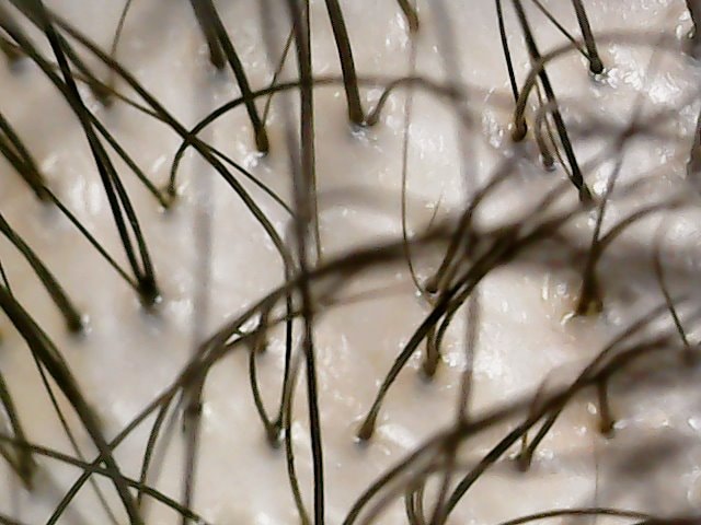 정수리