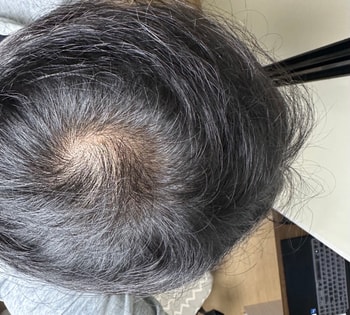 현재 상태(불빛 바로 아래서 찍었습니다)
