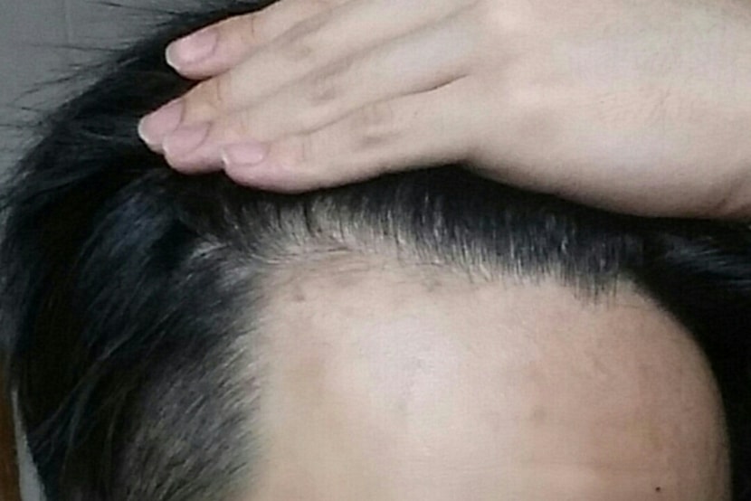 약 먹고 난 이후
