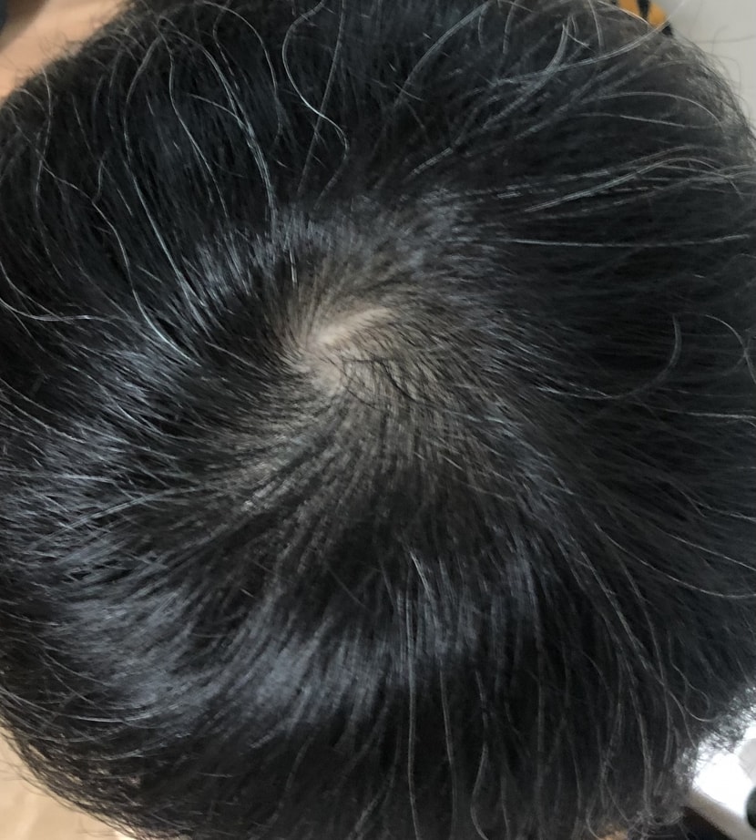 머리 다 말리고 정수리