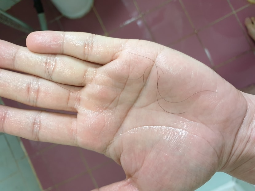 빠진 머리카락