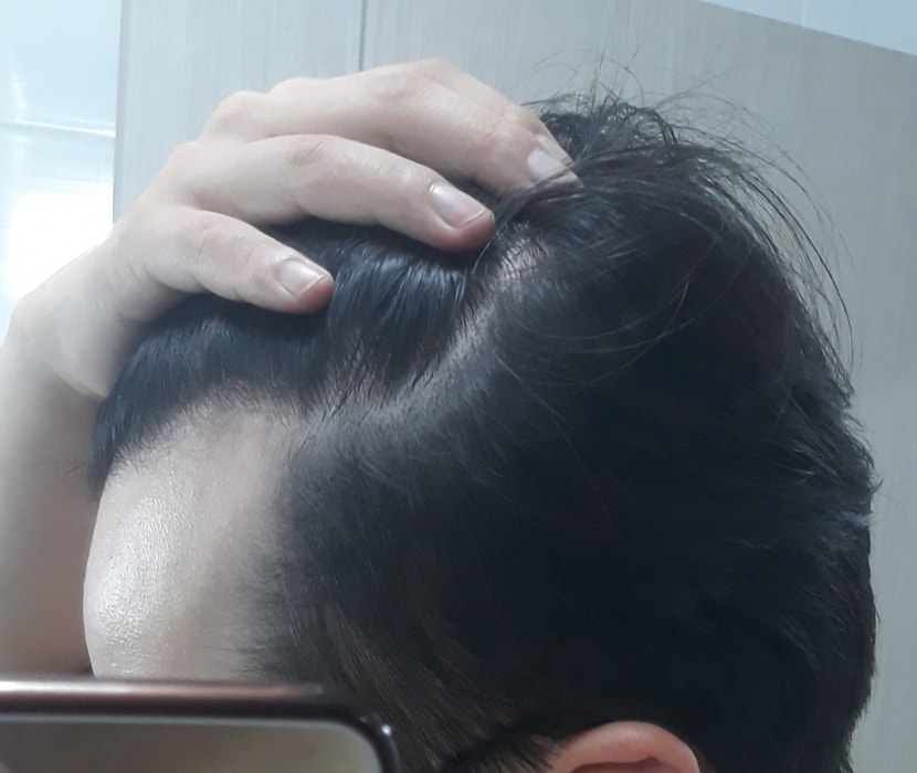 오른쪽