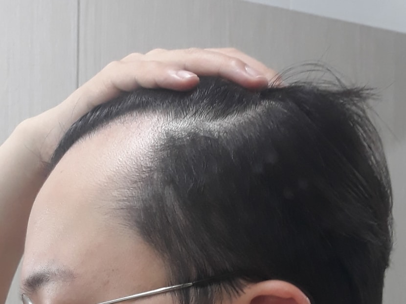 오른쪽