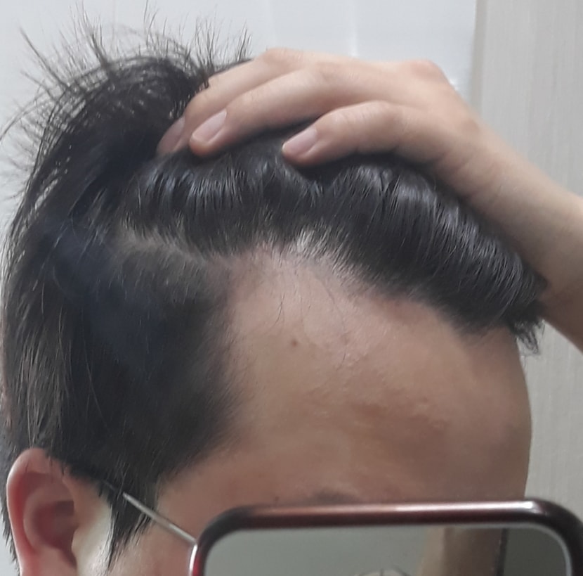 왼쪽