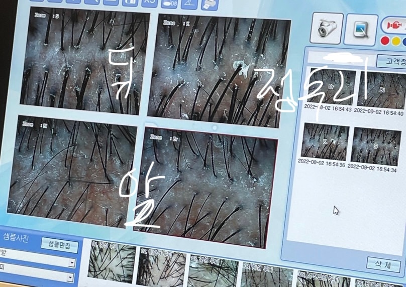 피부과에서 찍은거