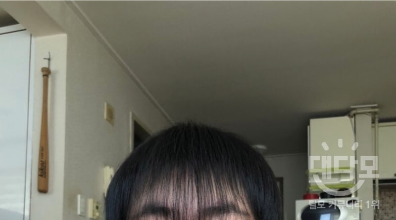 탈모약 끊은지 5개월 차 입니다.