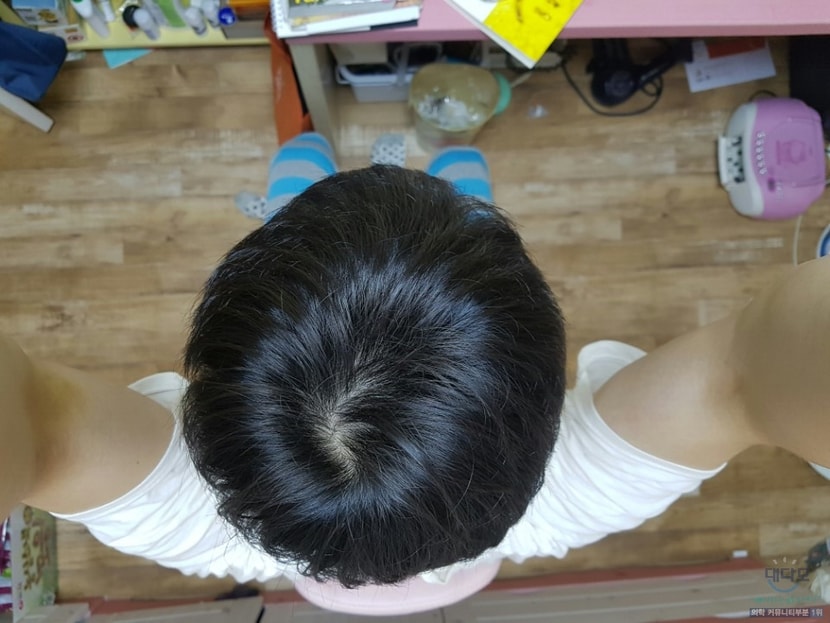 정수리 4개월