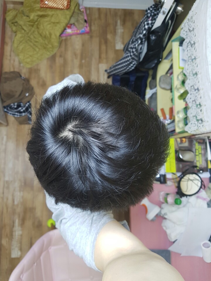 9개월 정수리3