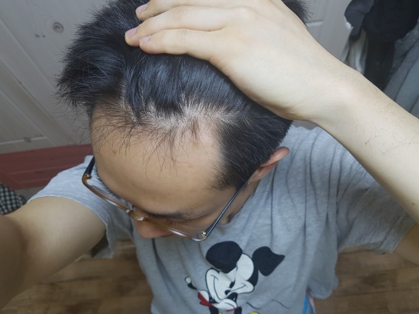 1년 엠자 좌측2 