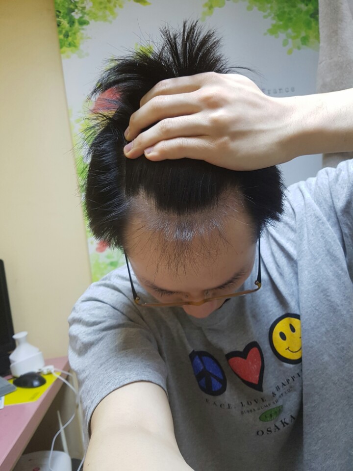 10개월 엠자 정면에서