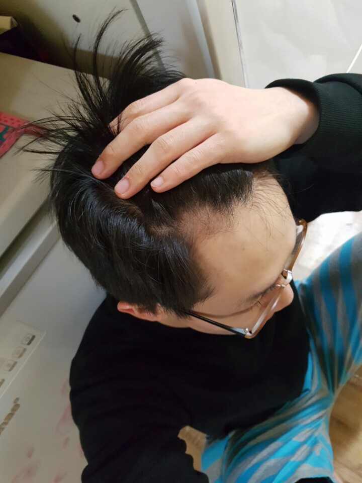 10개월 좌우측 엠자2