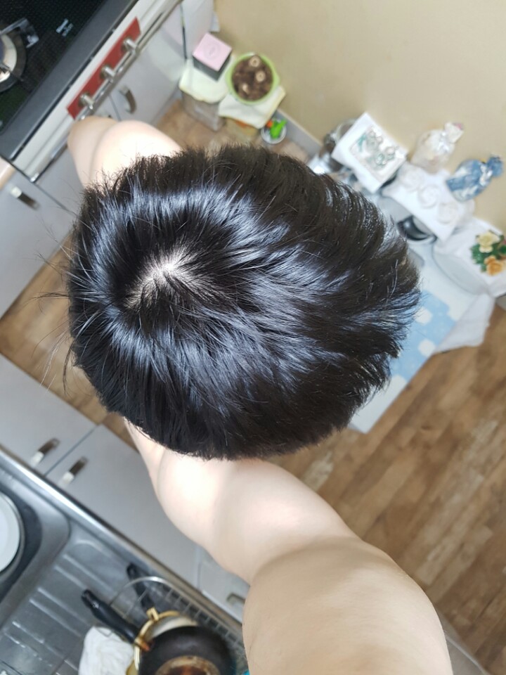 9개월 정수리2