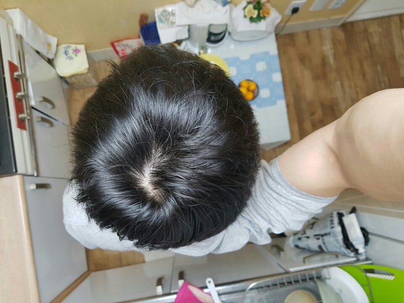 정수리 7개월