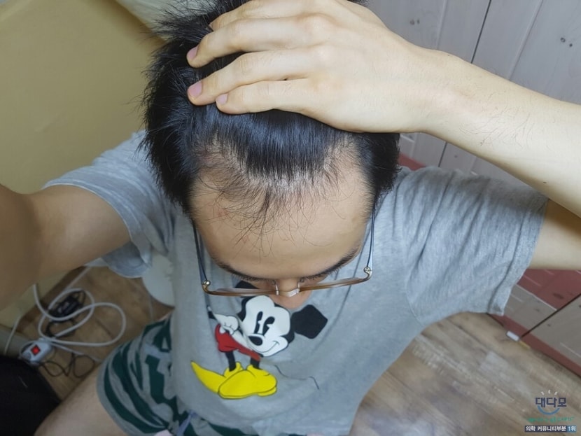 3개월 엠자 위에서 