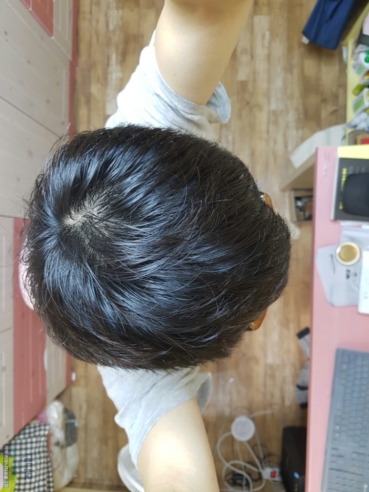 3개월 정수리1