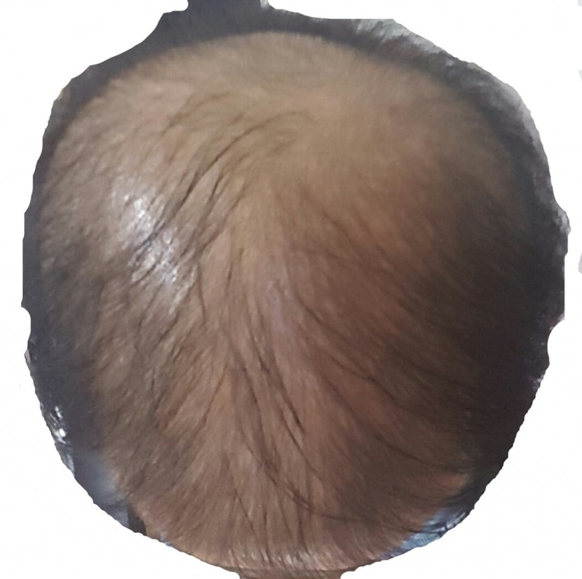 쉐딩 시작