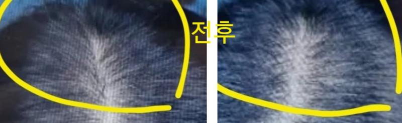 사진 한번만 봐주세요 죽고싶어요ㅠㅠ