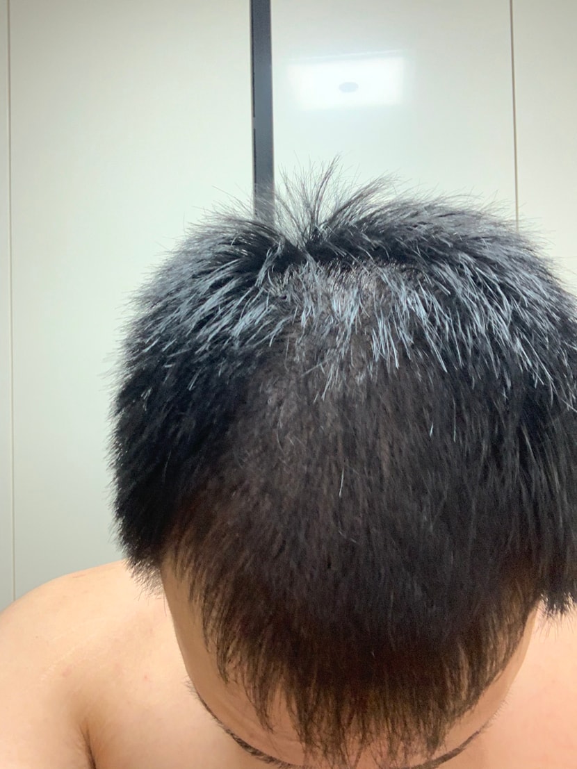 약섭취 얼마안됨 사진각도는 숙여서 찍음 머리