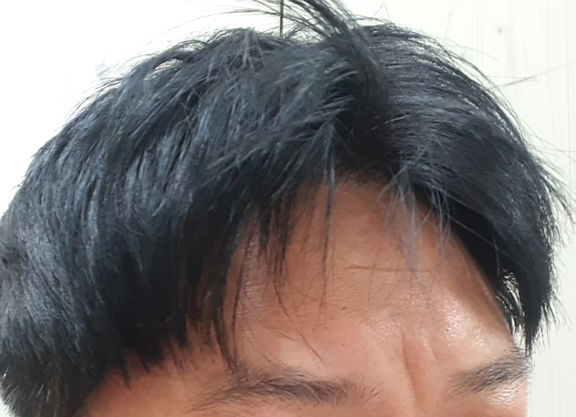 현재 우측