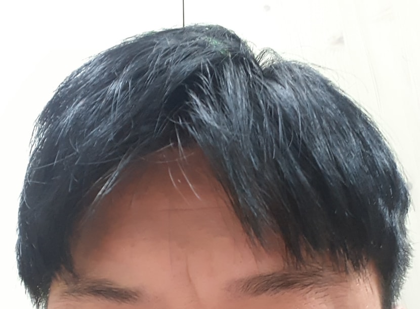 현재 정면