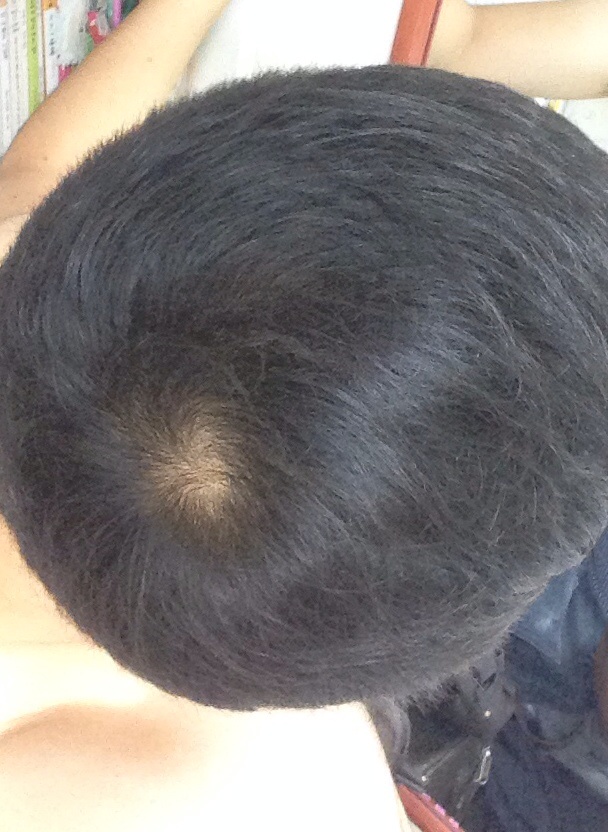 4개월 후 수건으로만 털어서 말림