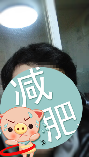 전역후 탈모진행 앞머리