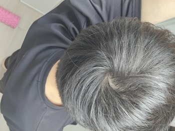 오늘찍은 현재 입니다. 조명이 밝은데는 더 정수리가 비쳐요!!