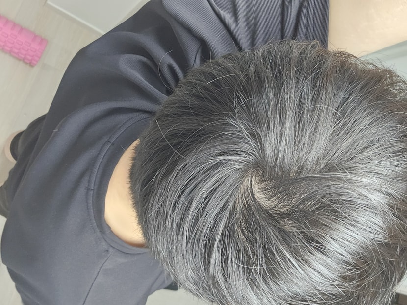 오늘찍은 현재 입니다. 조명이 밝은데는 더 정수리가 비쳐요!!