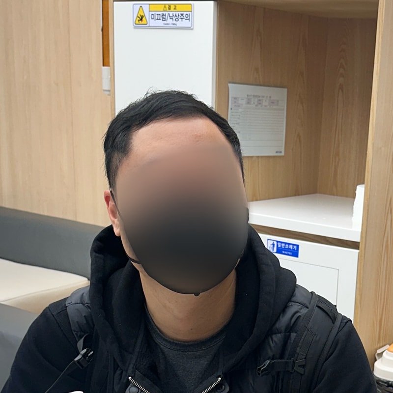 스트레스 받으면 머리 더빠져서 그냥 머리했습니다 후~~련합니다 그냥