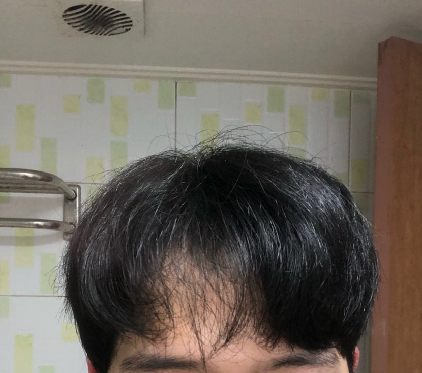 샤워후