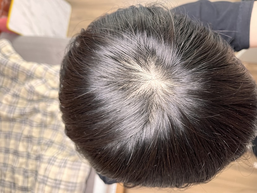 5개월후