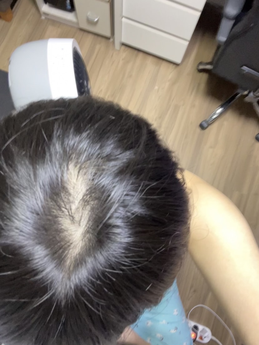 5개월전