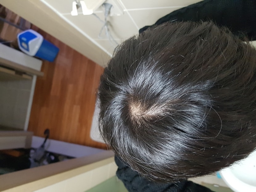 최근 사진은 더 이상 잘 안 찍어서 이게 12월 쯤..?