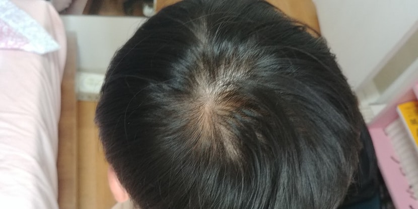 현재