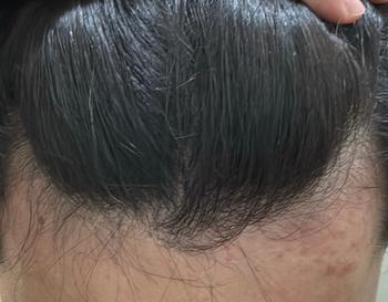 앞머리