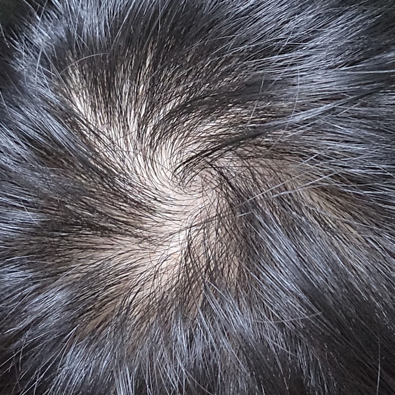 怎么判断有没有效果？