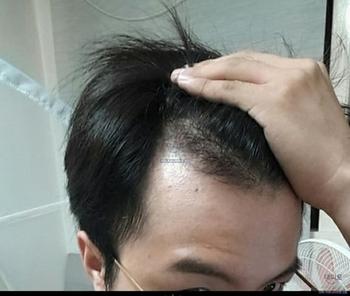 Before
