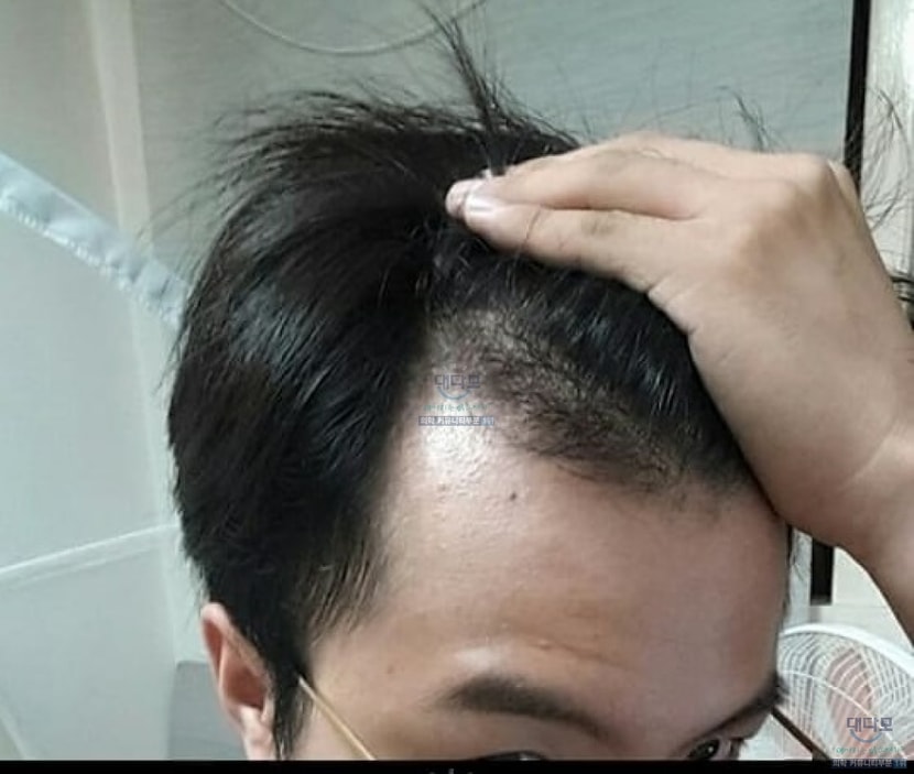 Before