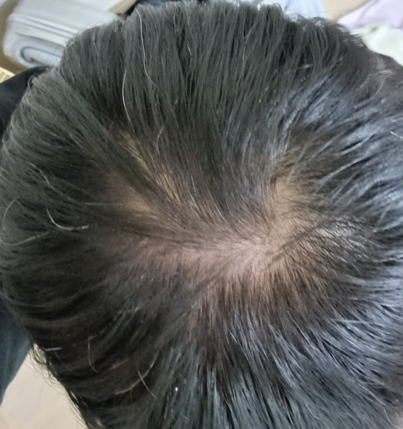 2년전 군입대 전 사진