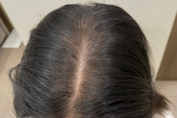 체크주사 패키지 관리 후